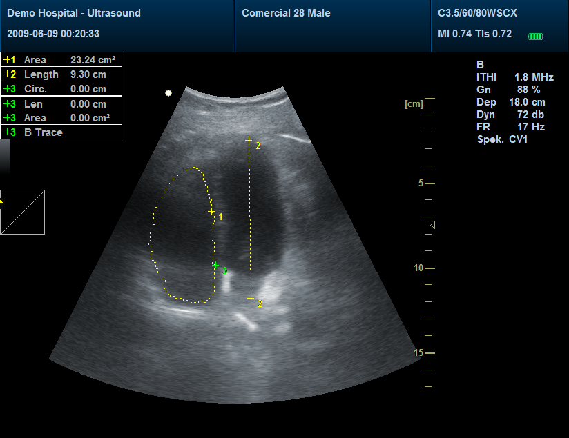 Ecógrafo doppler color, Ecógrafo 3D, 4D