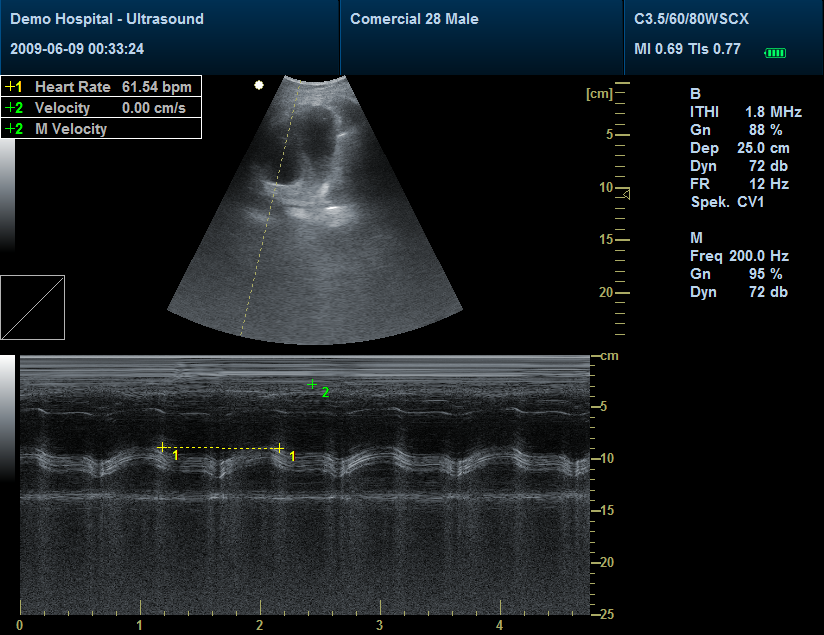 Ecógrafo doppler color 3D, 4D, Ecógrafo portátil doppler