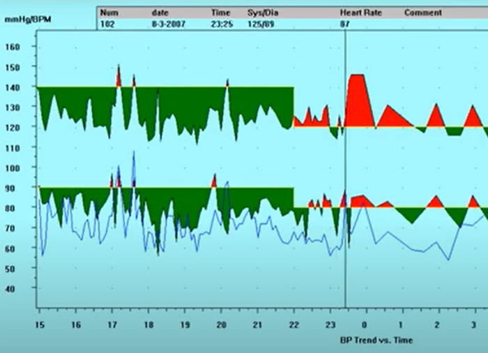 Holter Holter: Monitor de presión ambulatoria que puede medir y monitorizar la presión arterial del cuerpo humano por 24 horas.