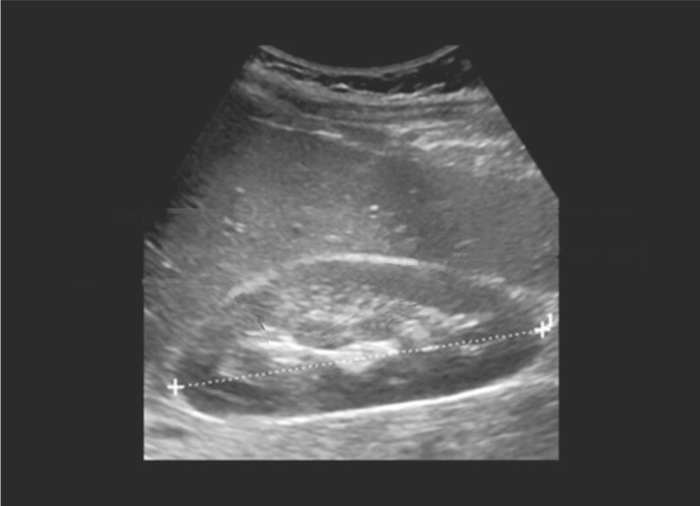 Eco doppler Eco doppler: El CMS1700A es un Ecógrafo Doppler de alta precisión con una plataforma informática de alto rendimiento. Se puede aplicar a muchas áreas de diagnóstico y tratamiento.