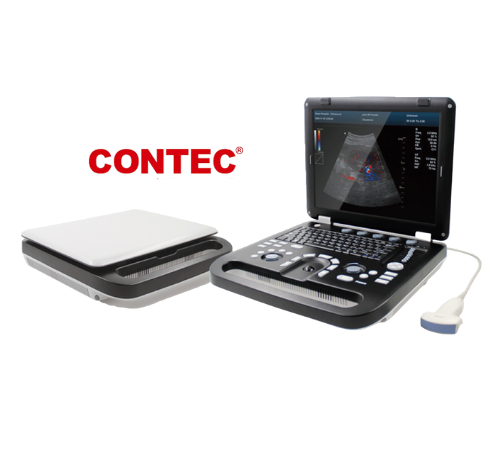 Eco doppler: Pantalla LCD de gran definición, con lo que se ve con gran calidad el estudio Médico. 