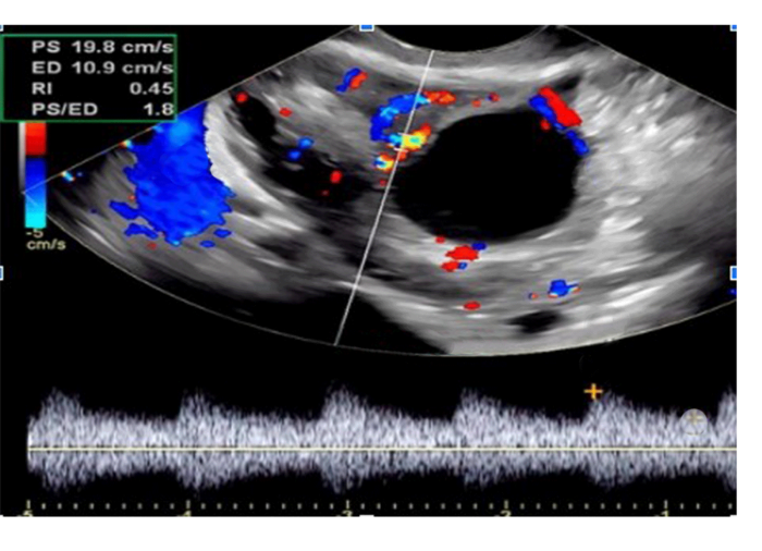 Eco Doppler Eco Doppler: Software integrado con módulos para la observación y diagnóstico de múltiples estructuras del cuerpo humano