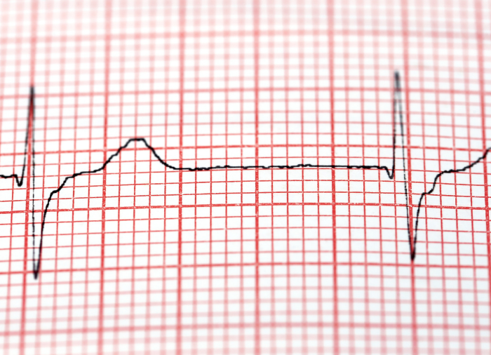 Electrocardiografo: portátil, liviano con la capacidad de recoger la señal de ECG de 12 derivaciones e imprimir la forma de onda mediante el sistema de impresión térmica.