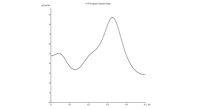 Holter: Se puede realizar una revisión rápida del estudio analizando una o varias derivaciones a la vez.