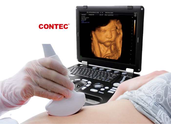 Ecógrafo doppler color, Ecógrafo 3D, 4D, Ecógrafo portátil doppler