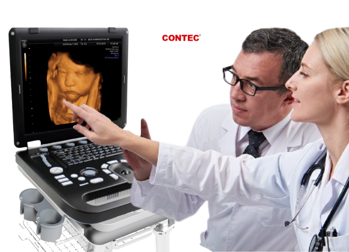 Ecógrafo doppler Ecógrafo doppler color, Ecógrafo 3D, 4D, Ecógrafo portátil doppler