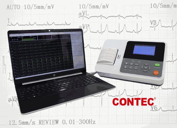 Electrocardiógrafo 12 derivaciones - Electrocardiógrafo 3 canales - Conexión a PC - ECG E3
