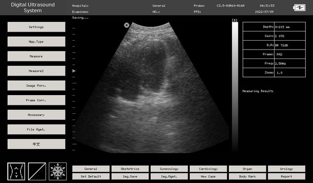 Ecógrafo bidimensional portátil - Ecógrafo Quito - Ecógrafo 