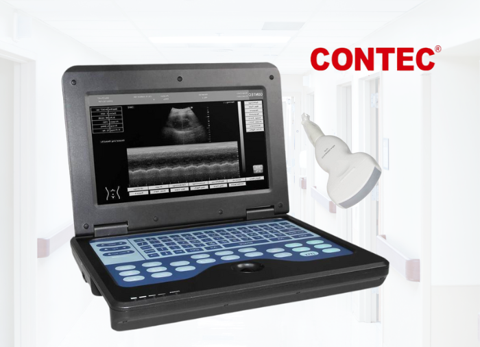 Ecógrafo portátil Ecógrafo bidimensional portátil, Ecógrafo portátil