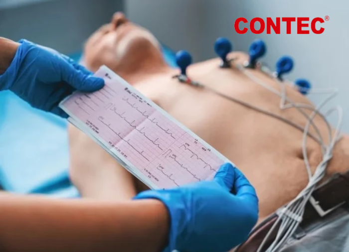 Electrocardiografo: Posee 3 horas de autonomía , puede ser utilizado en  el lugar que se requiera, Su sistema de autocorrección del estudio, garantiza una alta precisión y fiabilidad. 