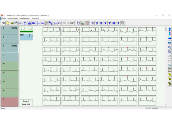 Holter 5 derivaciones Holter 3 canales - 5 derivaciones - Holter portátil - Holter de arritmias