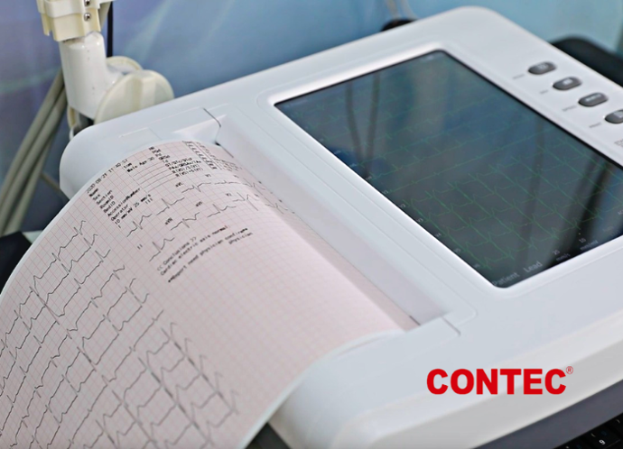 Electrocardiografo 12 canales-12 derivaciones- electrocardiografo