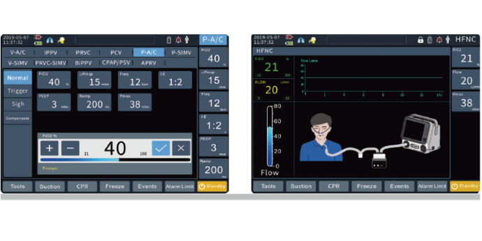 Ventilación mecánica: Operación facil e intuitiva con pantalla táctil 10.4″de alta definición.