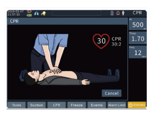 Ventilación mecánica: Instrucciones claras de RCP visual y audible según las últimas normas de AHA y ERC.