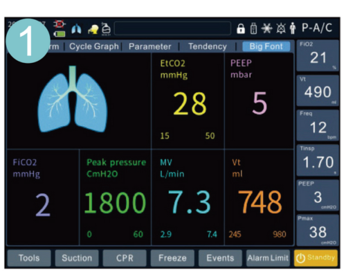 Ventilación mecánica: ofrece modos inteligentes como pulmón dinámico, herramientas de maniobra de reclutamiento (RM),herramientas P-V.