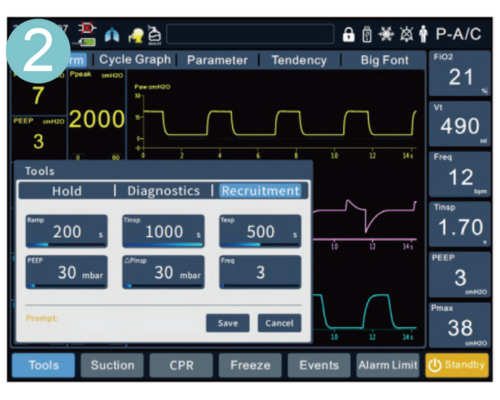 Ventilación mecánica: Terapia de oxígeno de alto flujo( flujo máximo es 65 l/min)