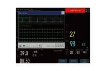 Desfibrilador manual - DEA - marcapasos - Dea desfibrilador 