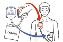 Desfibrilador uso profesional - Equipo de reanimación cardiopulmonar