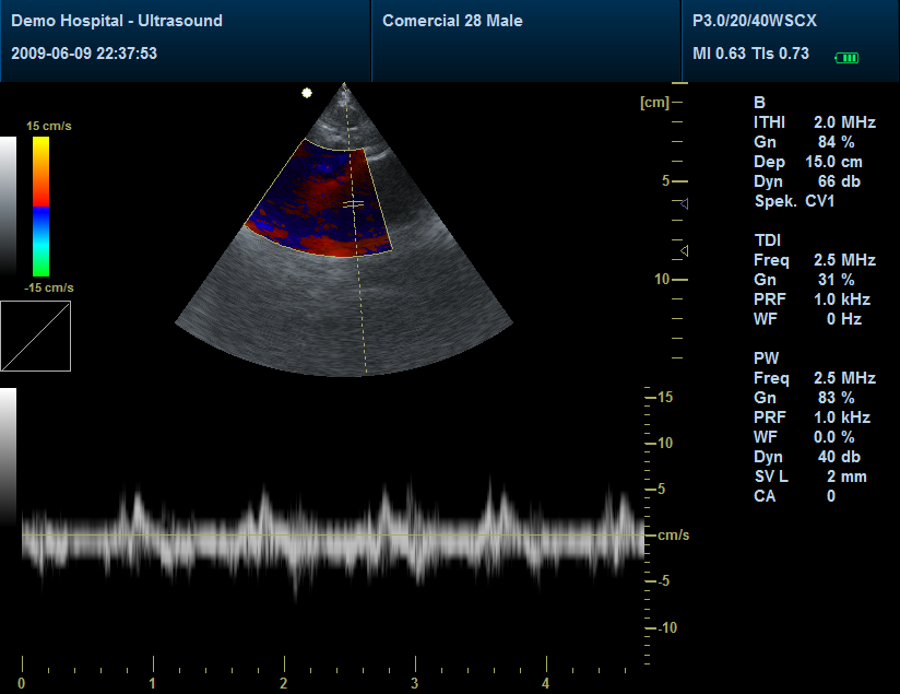 Ecógrafo Cardiológico, Ecógrafo Contec