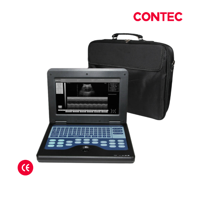 Ecografo portatil 10" tipo laptop, + 1 transductor convexo8