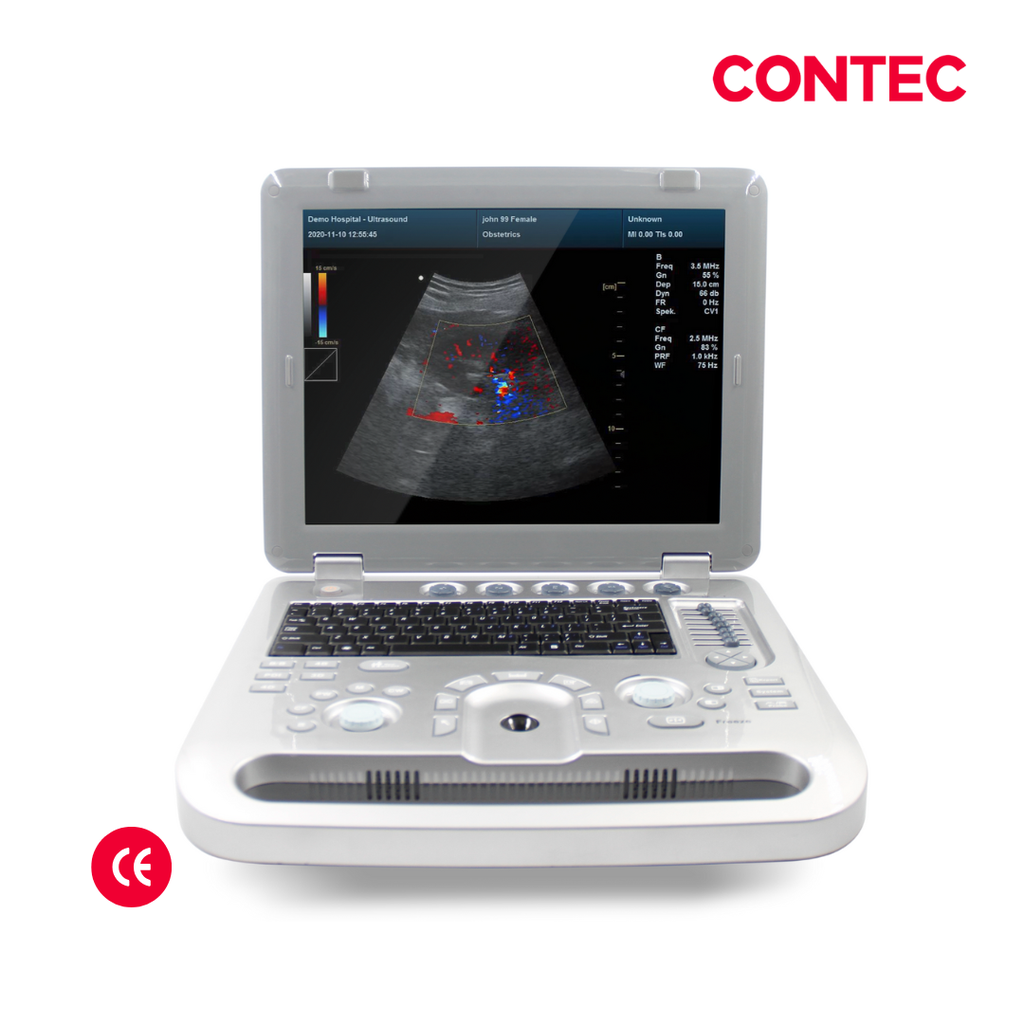 Ecografo Doppler color portatil, 15 pulgadas, Contec-2