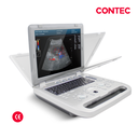 Ecografo Doppler color portatil, 15 pulgadas, Contec-3