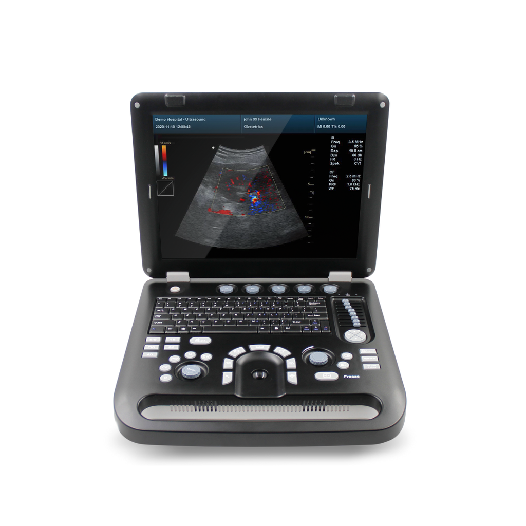 Ecógrafo 3D- 4d (4).png