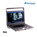 Ecografo Doppler color portátil. Advanced